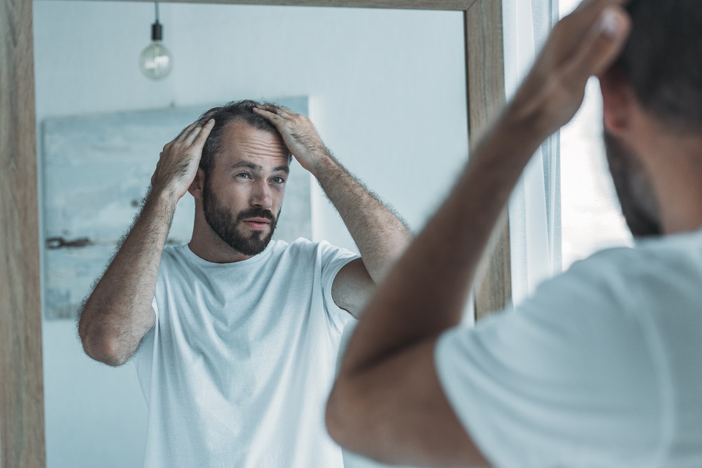 What You Should Know About Men's Hair Loss